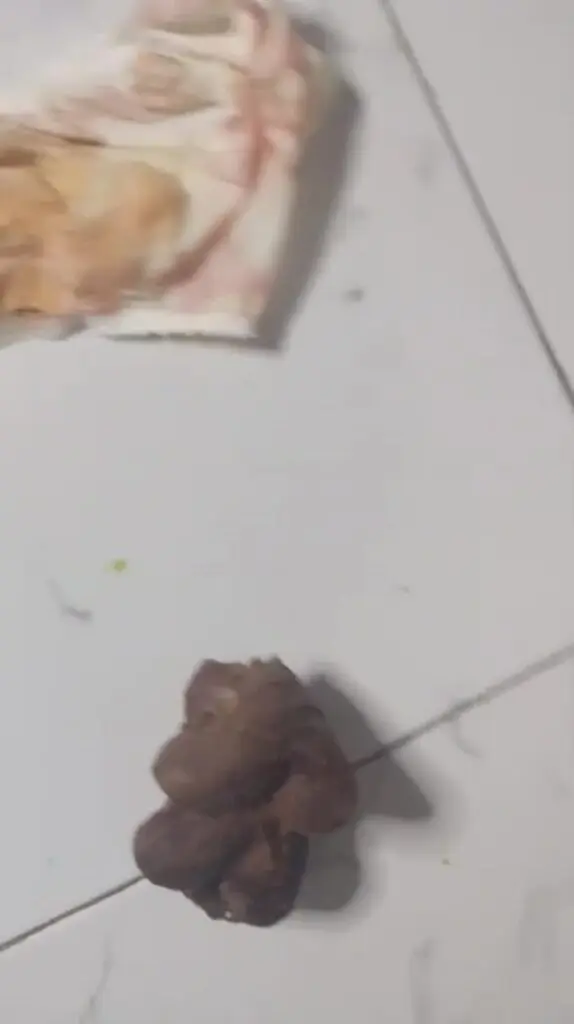 Poo in pants